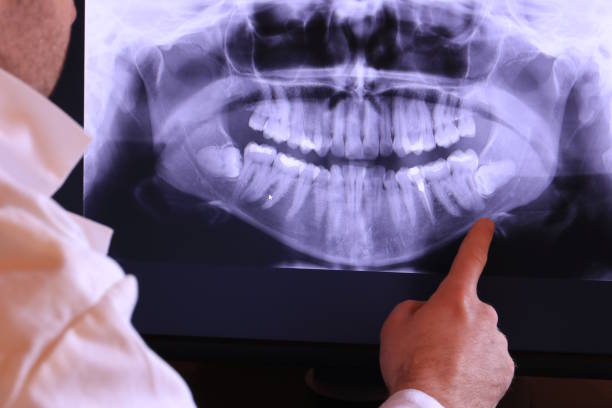 Best Emergency Root Canal Treatment in Junction City, KS